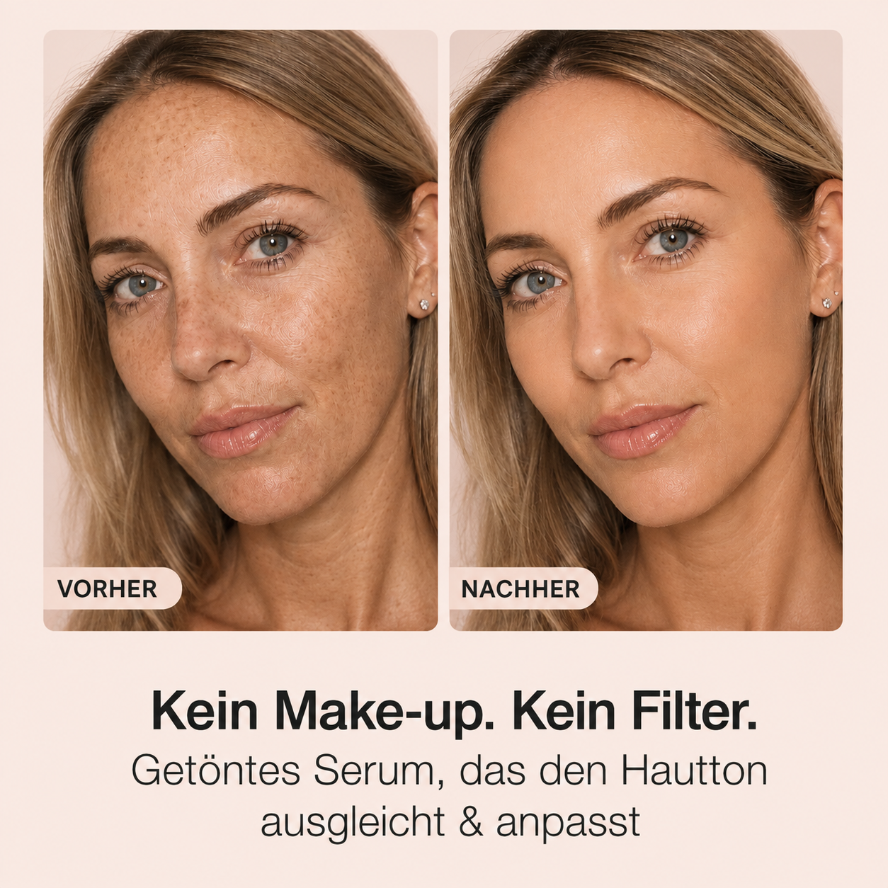 Tenta | Ebenmässige Haut